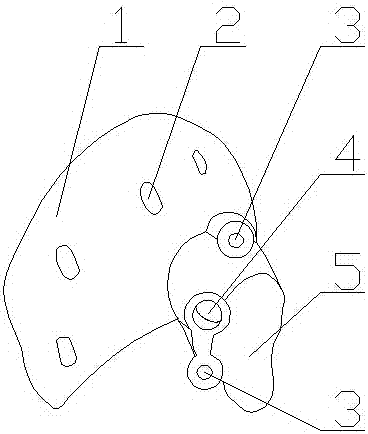 A percutaneous infratemporal fossa-outer orbital wall endoscopic puncture guide and its application method