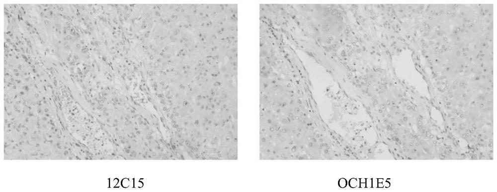 Cps-i antibodies and uses thereof