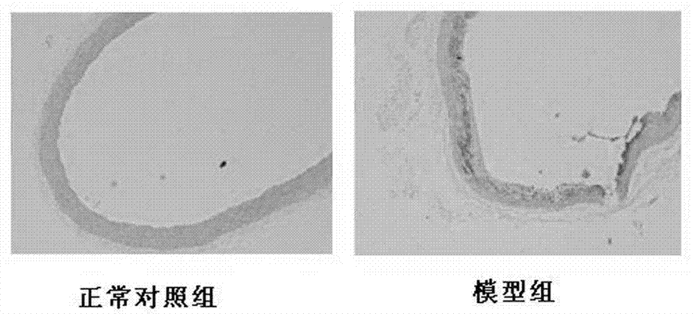 Application of polyhydroxy bromo-benzophenone compound and derivatives thereof in treatment and prevention of atherosclerosis