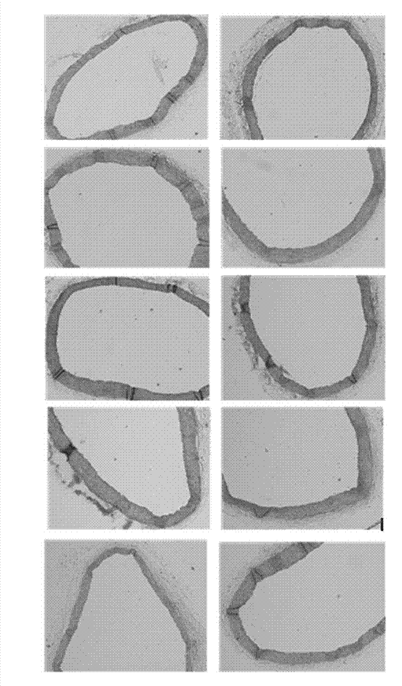 Application of polyhydroxy bromo-benzophenone compound and derivatives thereof in treatment and prevention of atherosclerosis