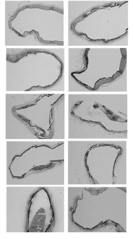 Application of polyhydroxy bromo-benzophenone compound and derivatives thereof in treatment and prevention of atherosclerosis