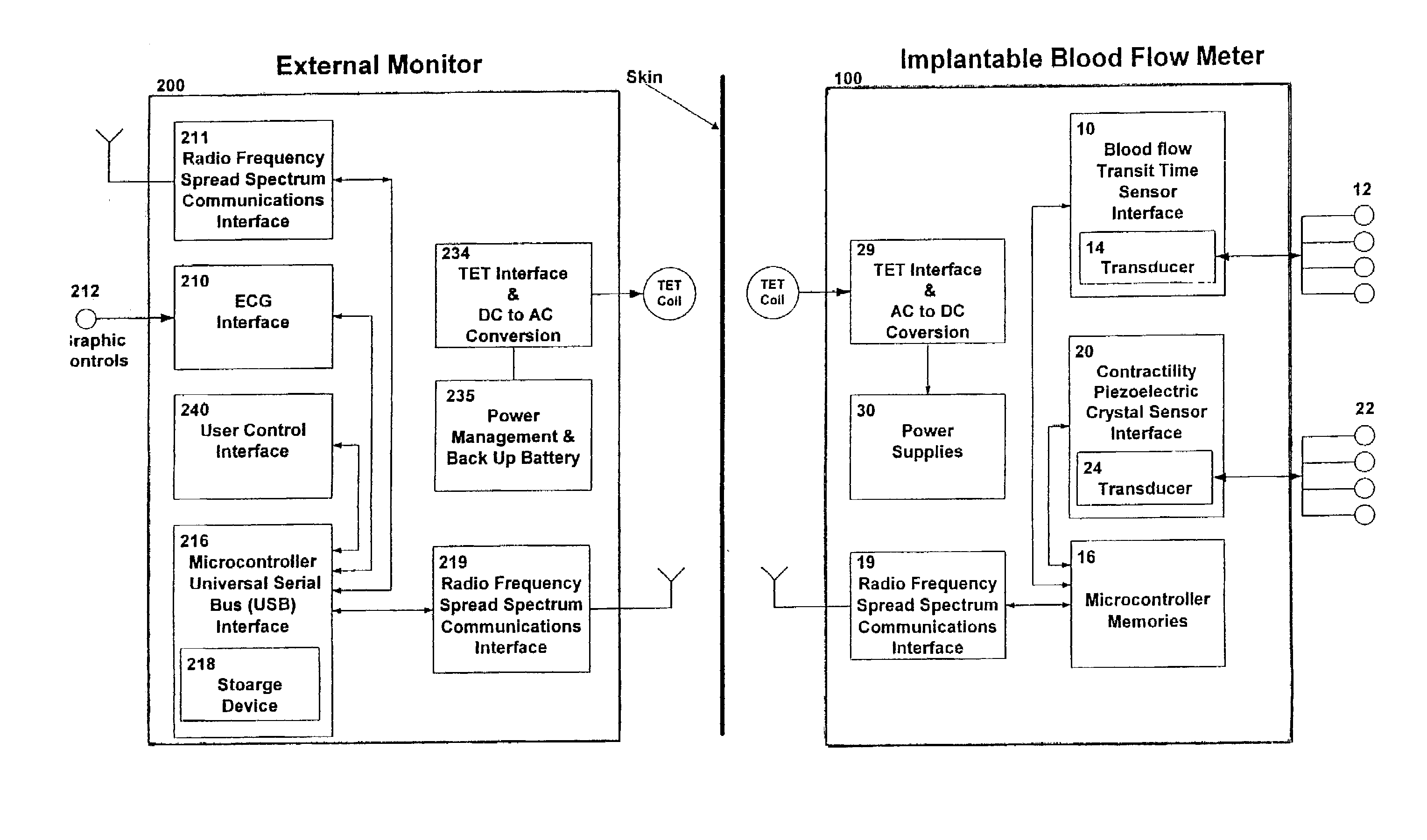 Implantable blood flow monitoring system