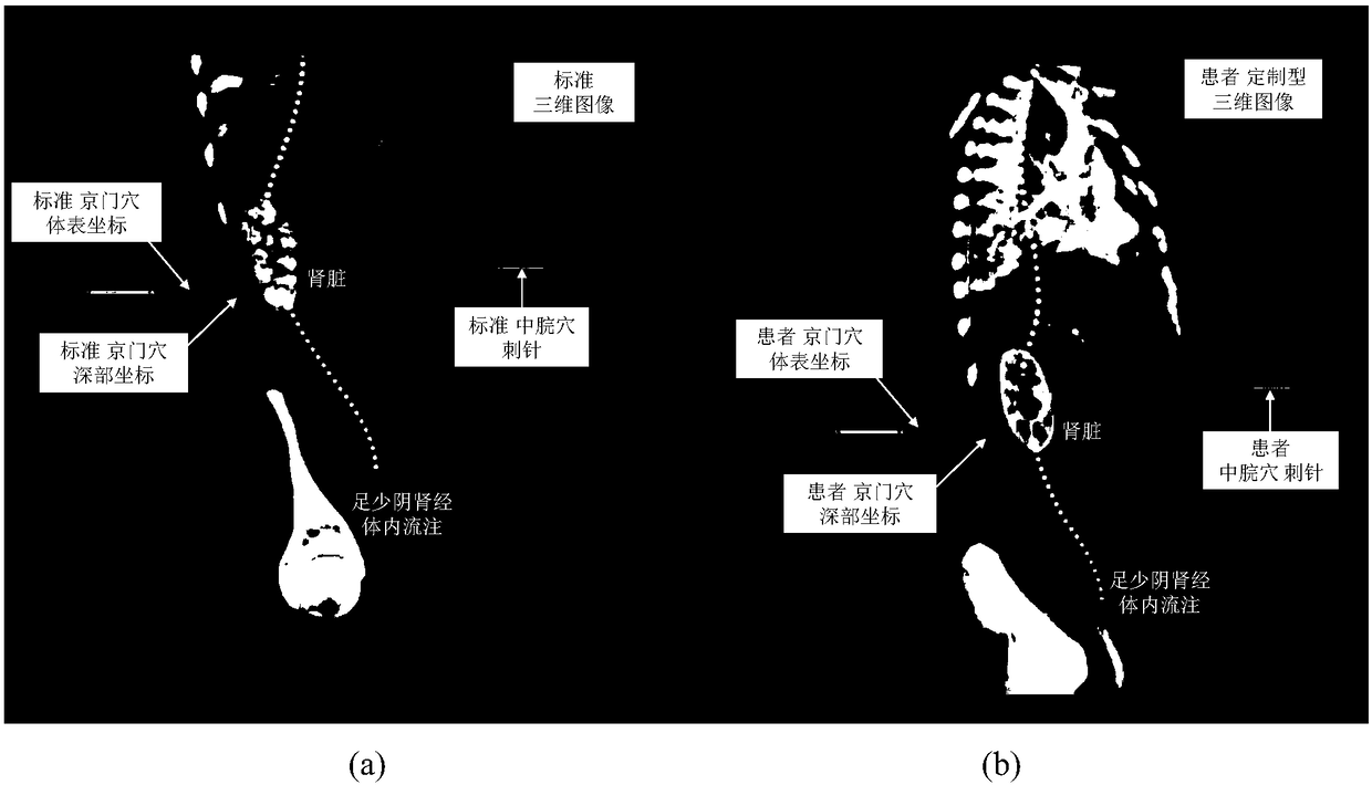 Three-dimensional acupuncture point mapping method and device