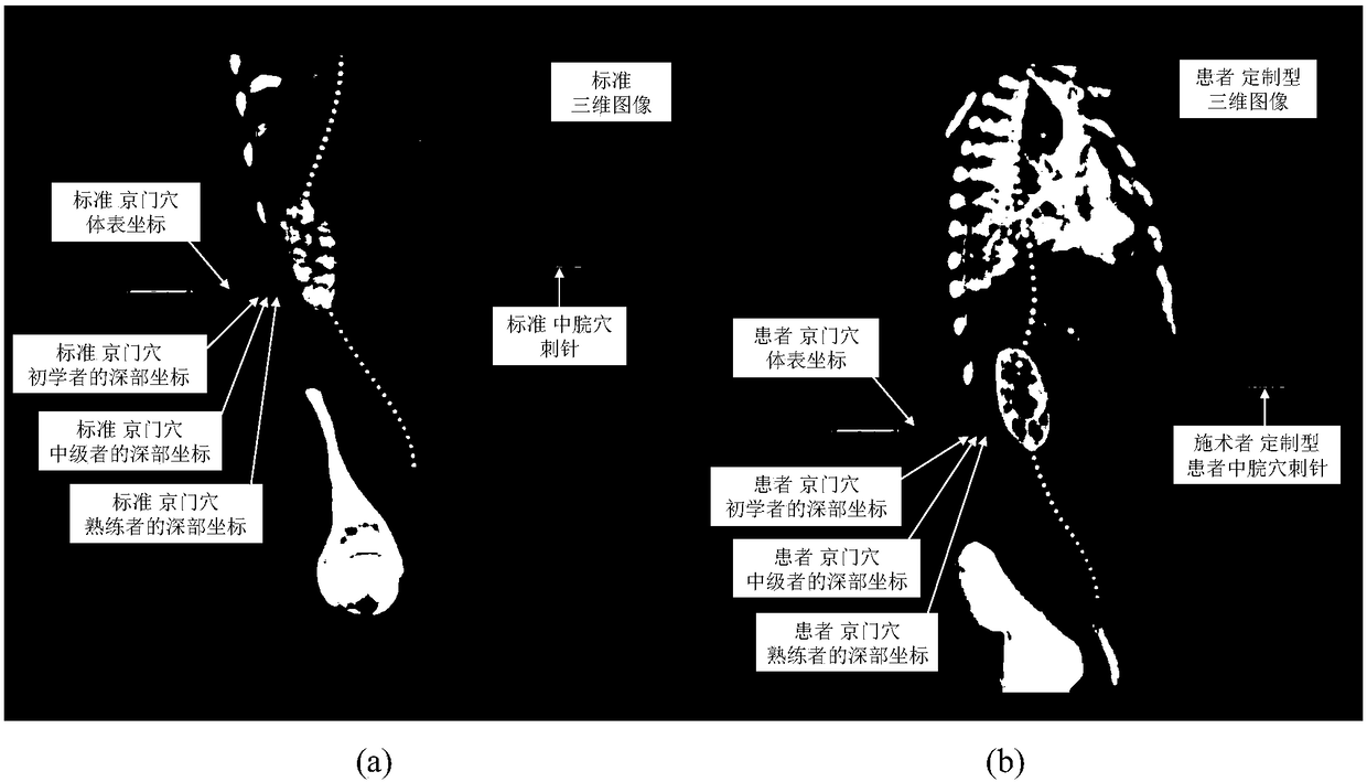 Three-dimensional acupuncture point mapping method and device