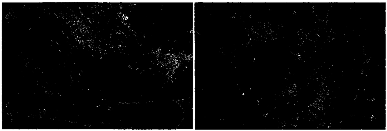 Application of mesenchymal stem cell culture from human umbilical cord or supernatant of mesenchymal stem cell culture