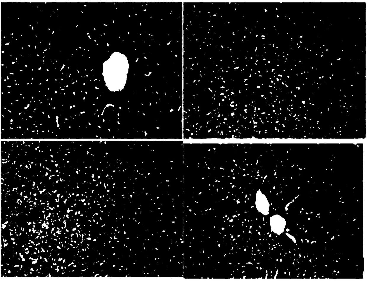 Uses of bicyclol and pharmaceutically acceptable derivative thereof in prevention or treatment of drug-induced liver damage