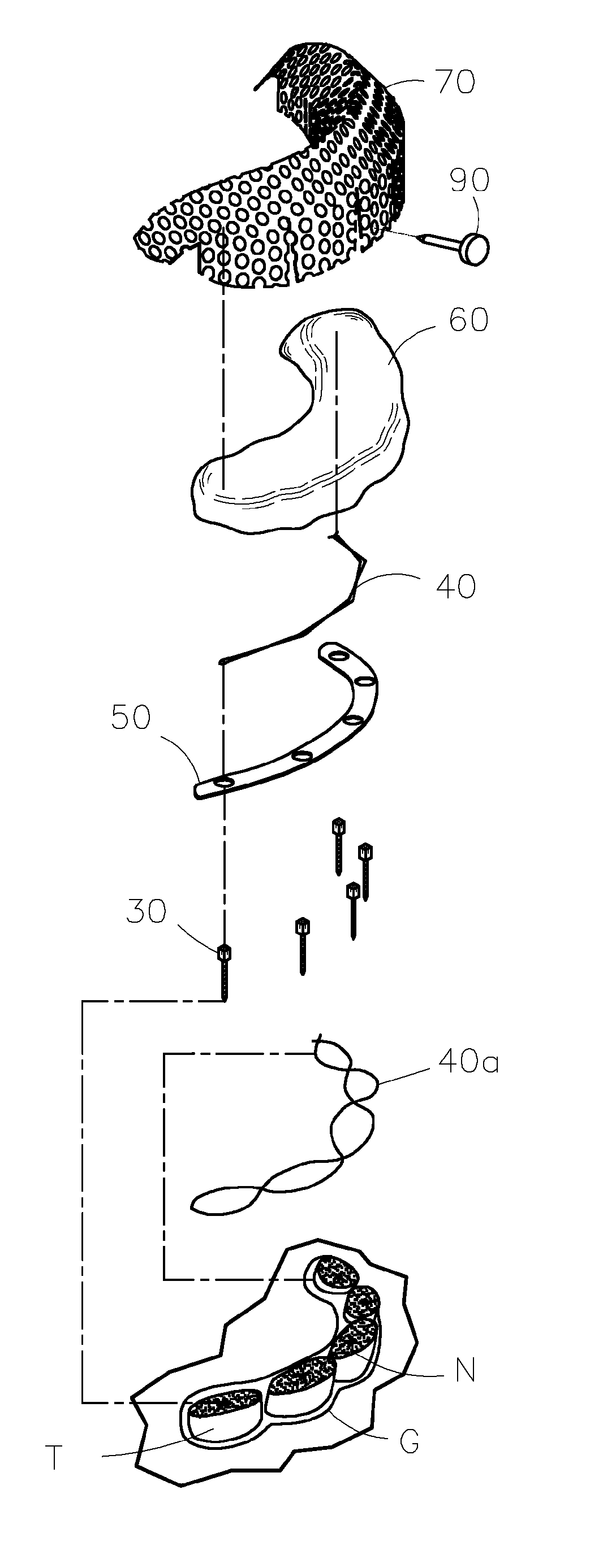 Dental prosthesis for cattle and method for mounting it