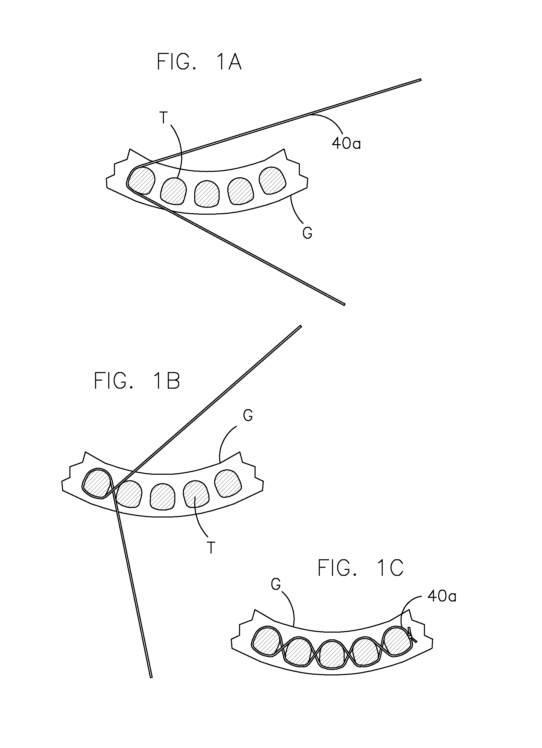 Dental prosthesis for cattle and method for mounting it