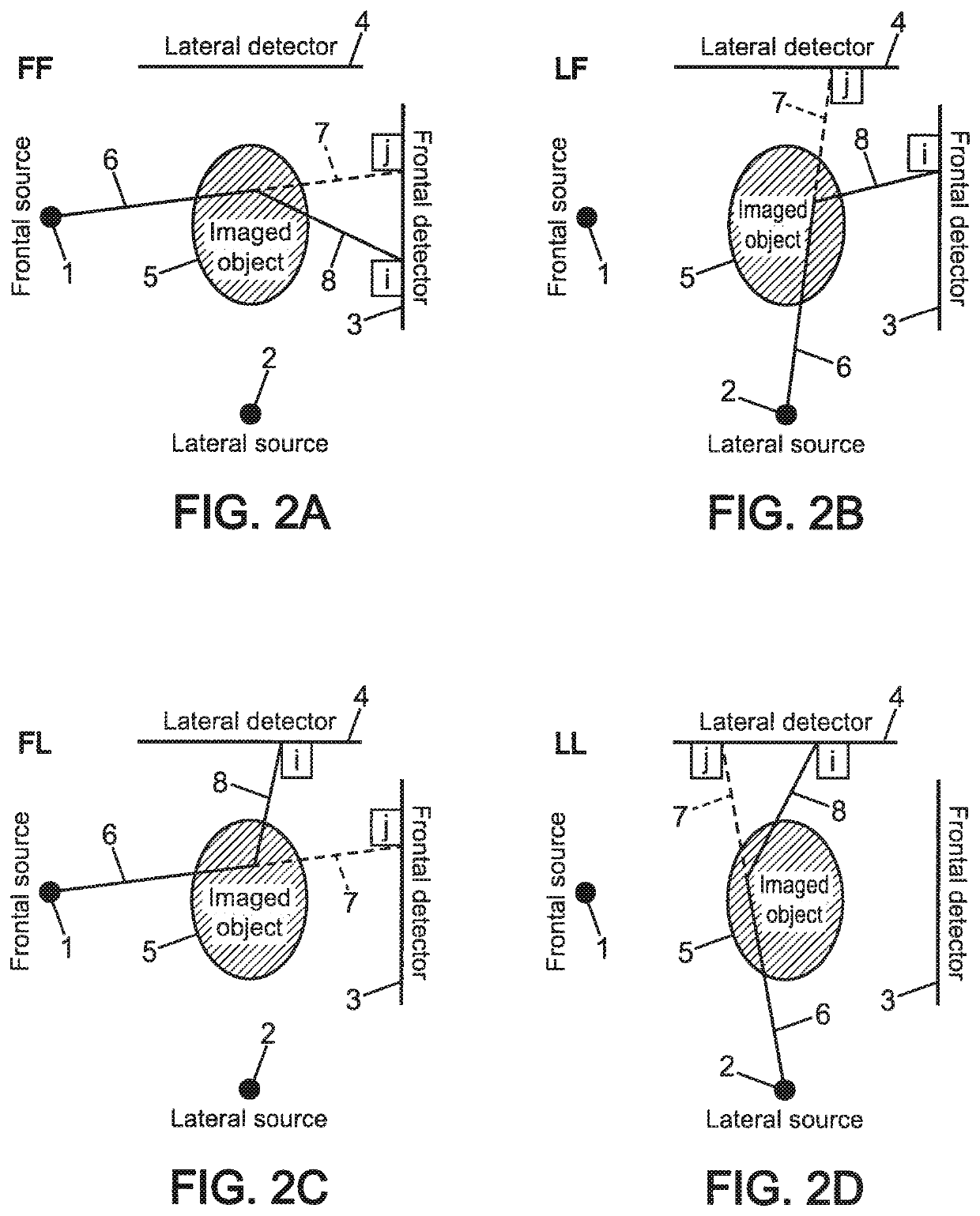 Method of radiography of an organ of a patient