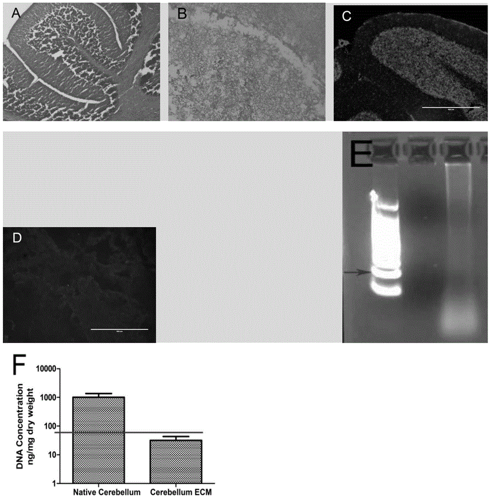 Cerebellar decellularized regeneration biological scaffold, preparation method and application thereof