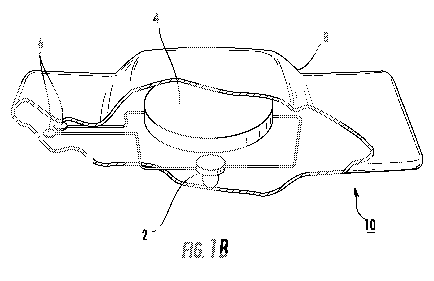 Intraoral light-emitting device