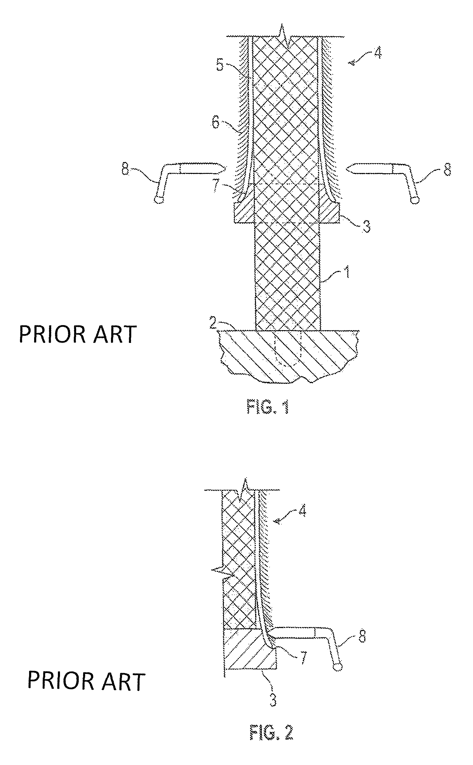 Hair controller for a pelt stretching machine