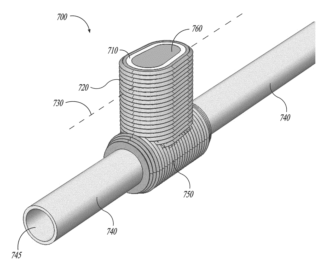 Corrugated microporous tissue interface for improved performance and infection resistance of vascular grafts and other implantable devices