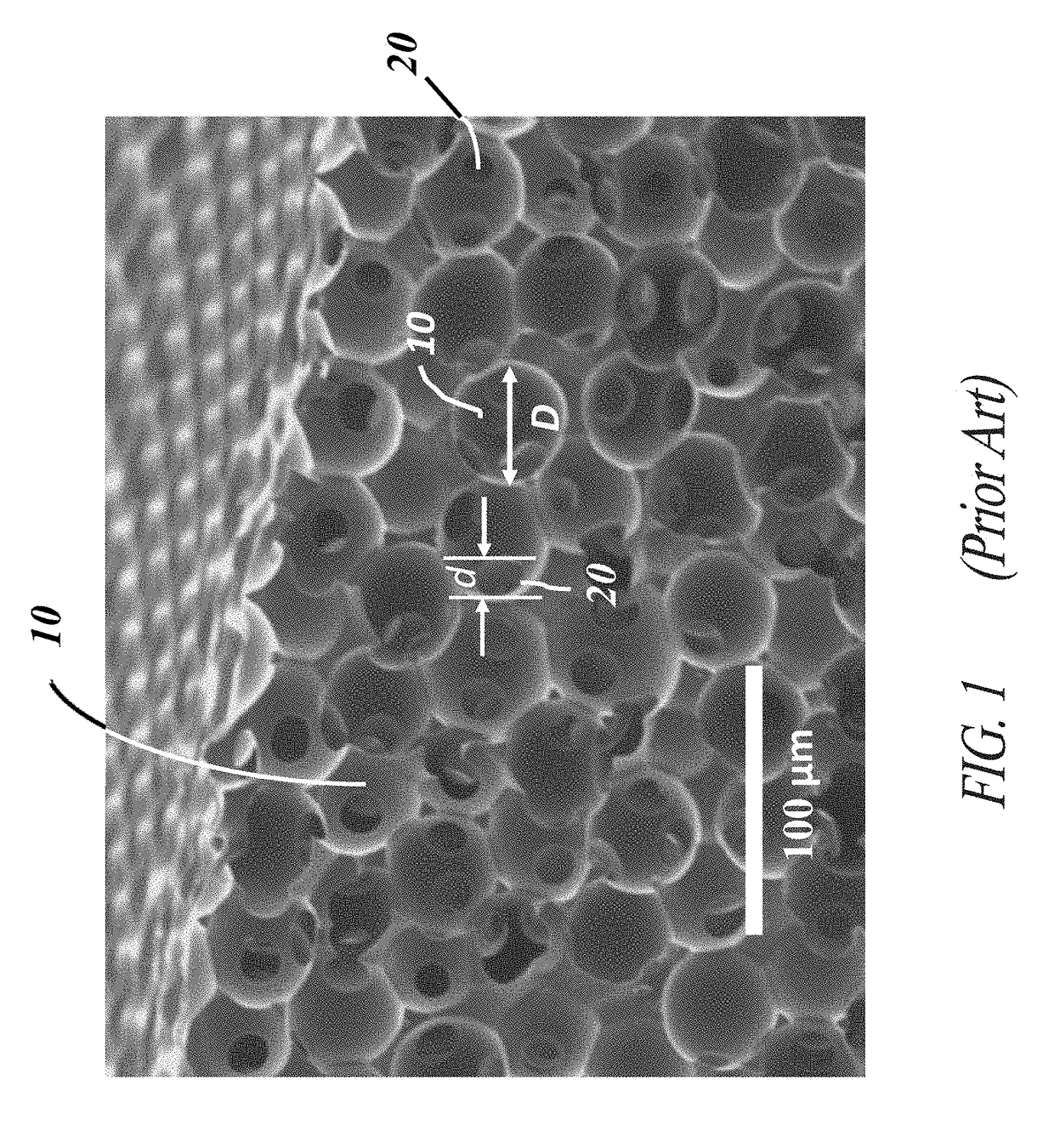 Corrugated microporous tissue interface for improved performance and infection resistance of vascular grafts and other implantable devices