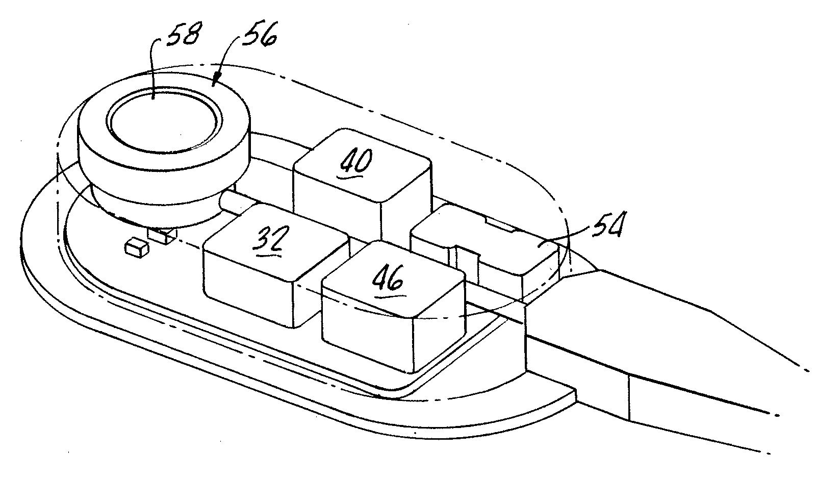 Implantable Pump System