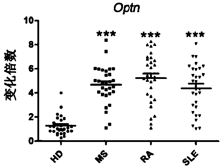 Application of Optineurin as target point in preparation of drug for preventing and treating autoimmune diseases