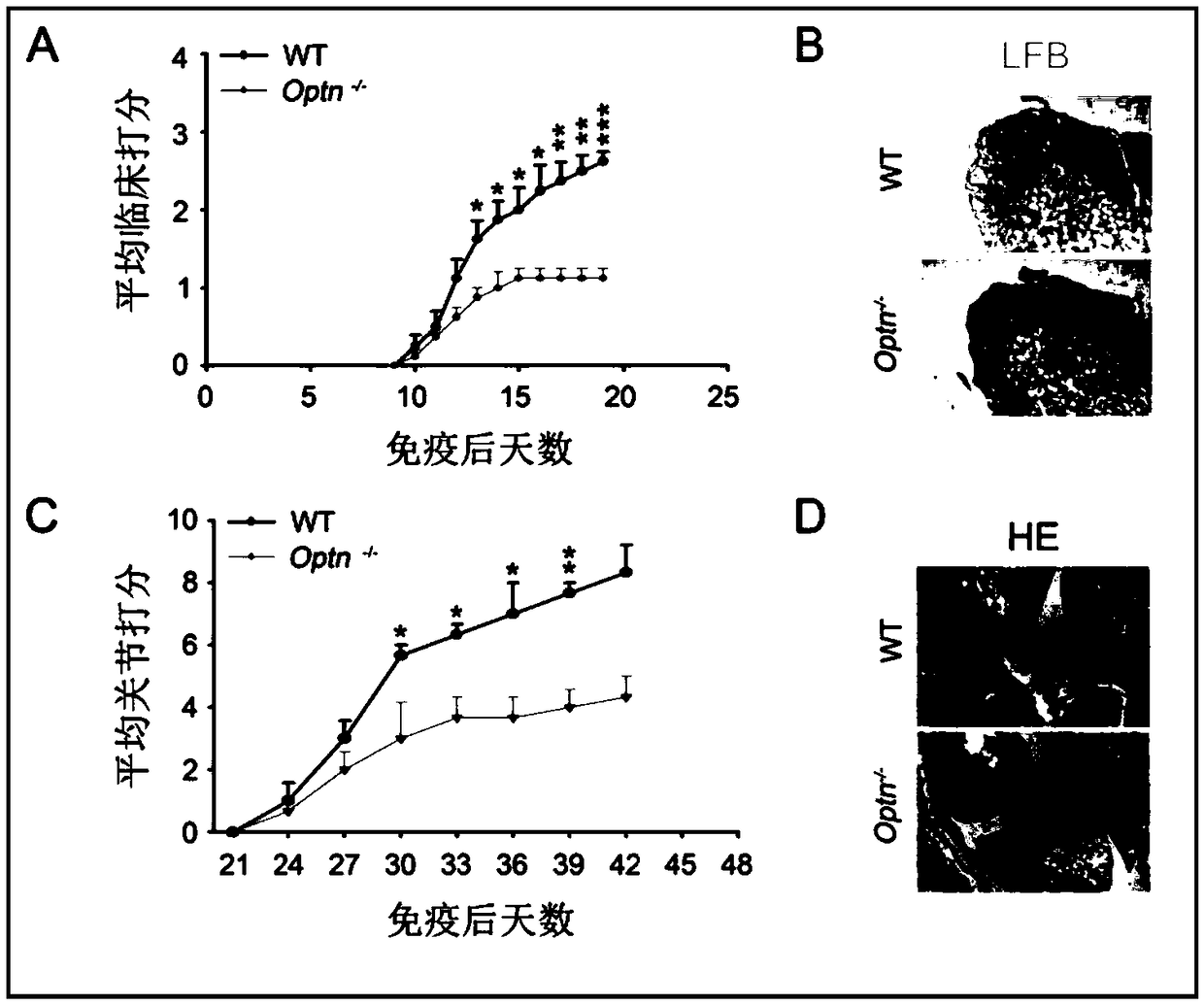 Application of Optineurin as target point in preparation of drug for preventing and treating autoimmune diseases