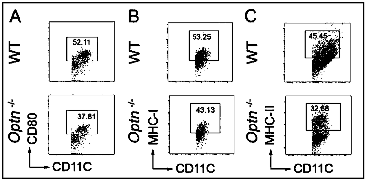 Application of Optineurin as target point in preparation of drug for preventing and treating autoimmune diseases