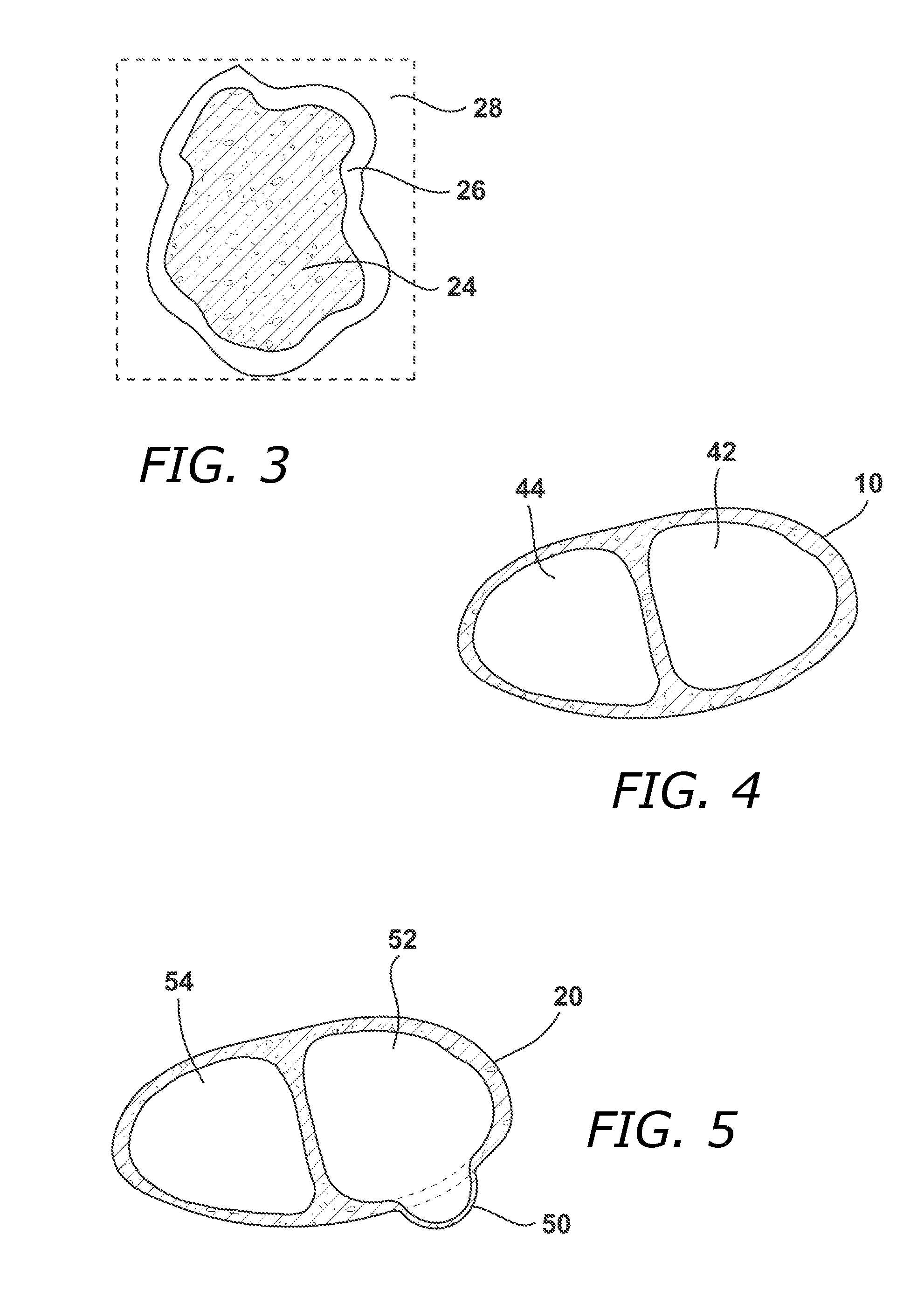 Methods and Systems for Treating Injured Cardiac Tissue