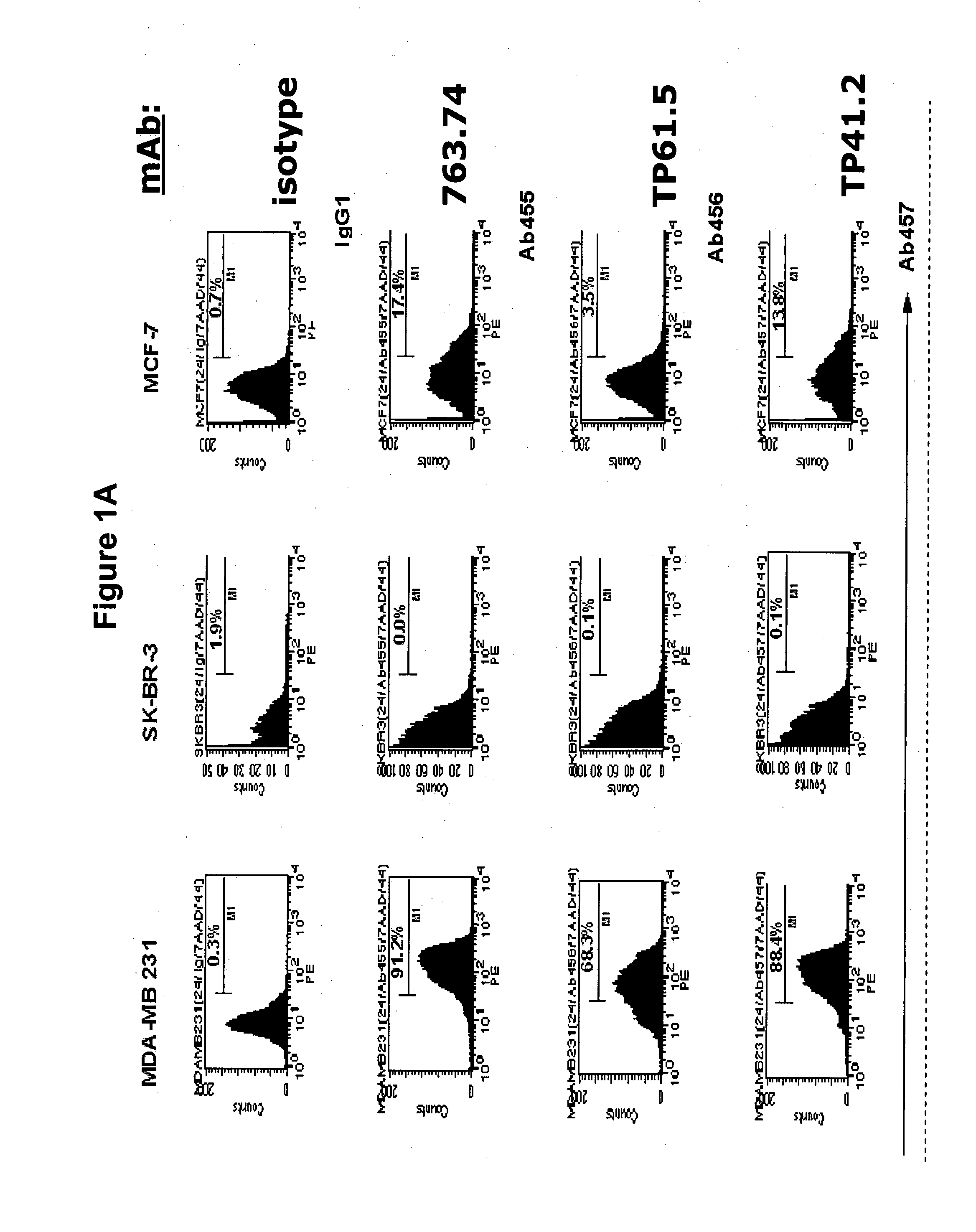 Inhibition of breast carcinoma stem cell growth and metastasis