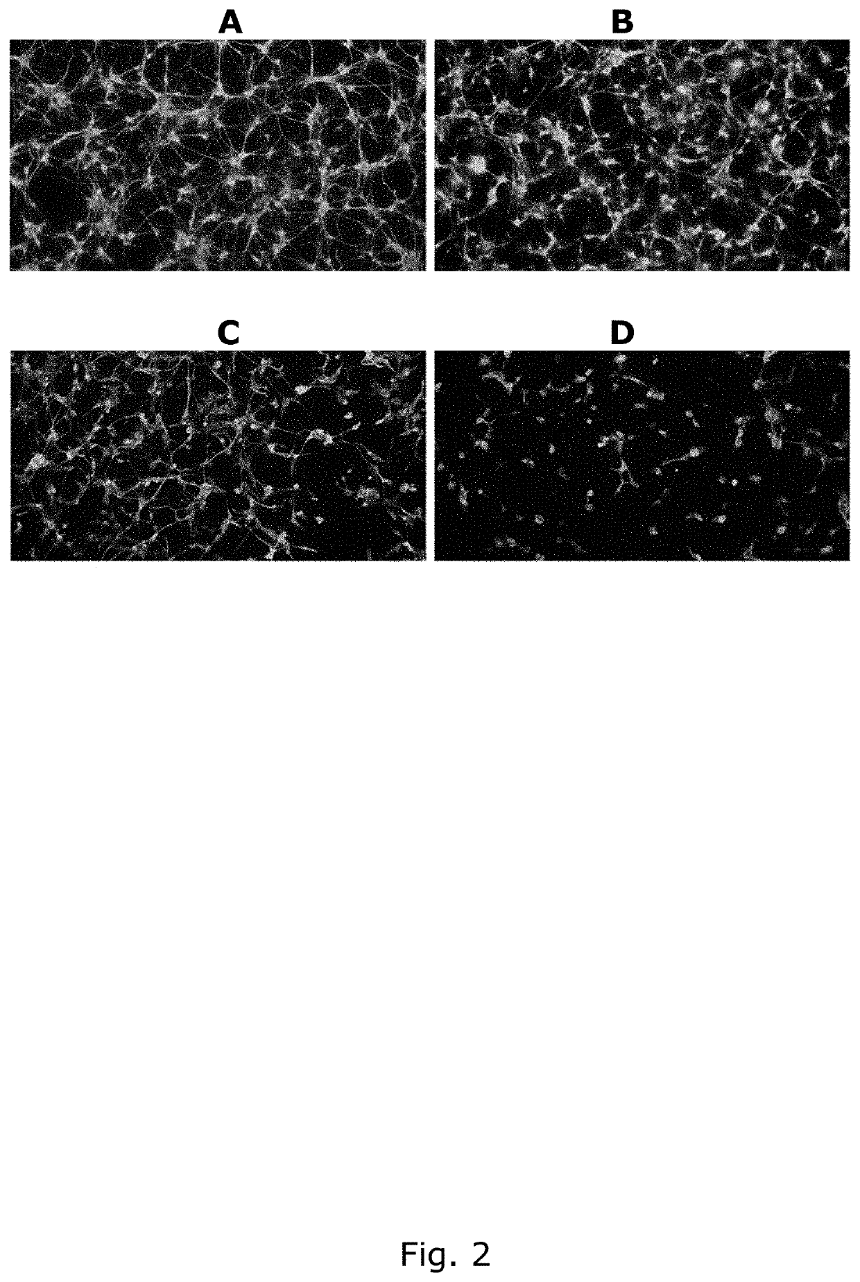 P-gp inducers as protectors against chemotherapy-induced side effects, such as peripheral neuropathy (CIPN) and hair loss