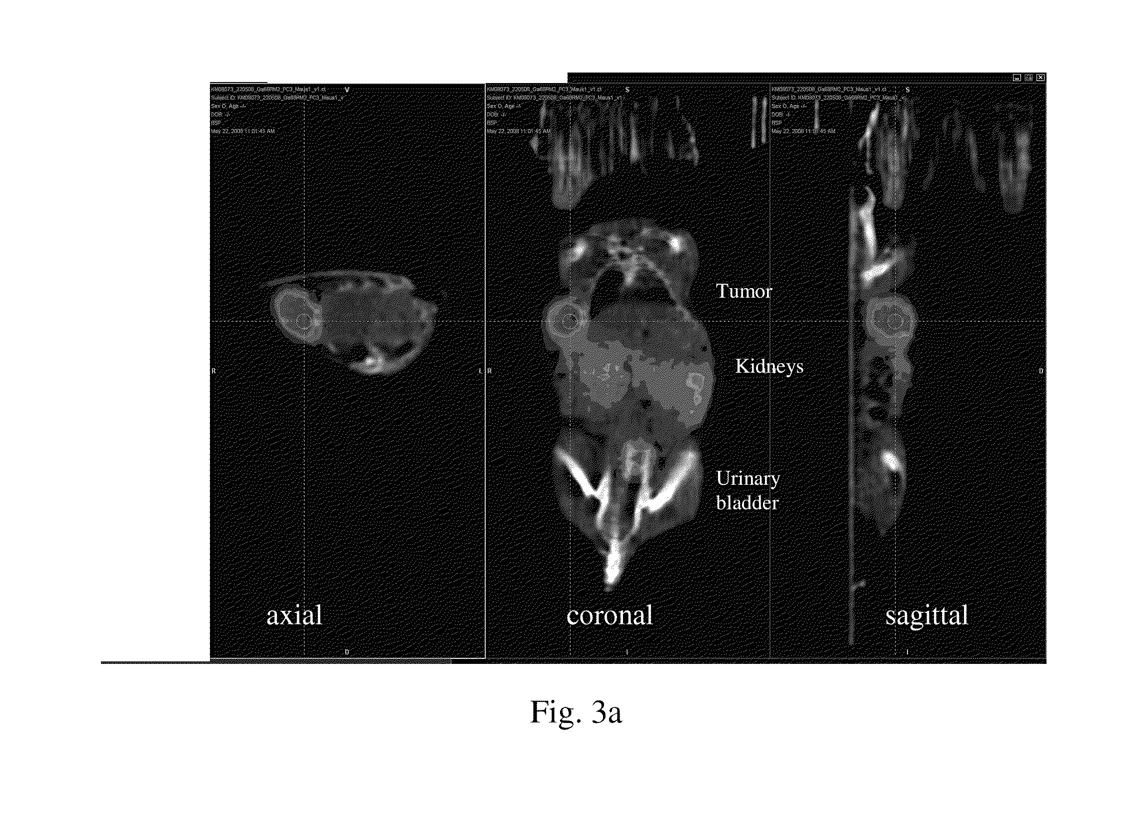 Bombesin analog peptide antagonist conjugates