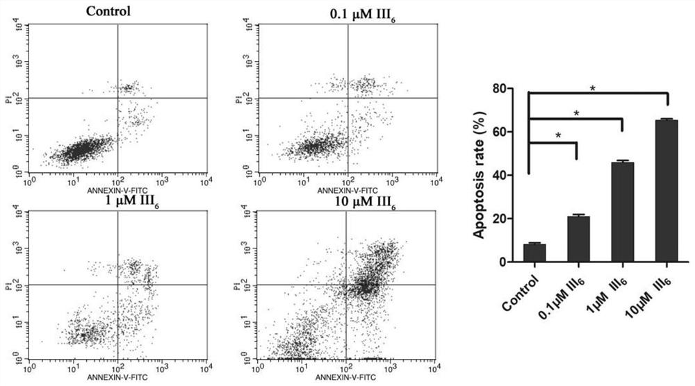 Novel protein kinase inhibitor, preparation method and application thereof