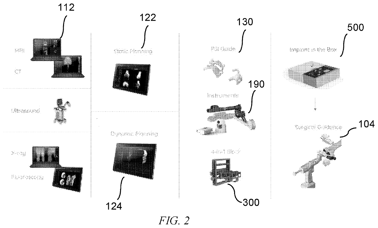 Methods and devices for knee surgery with inertial sensors