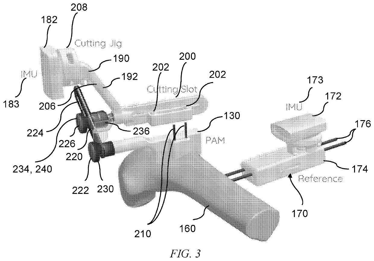 Methods and devices for knee surgery with inertial sensors