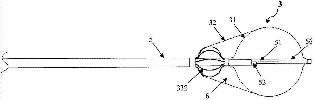 Cryoablation catheter and system