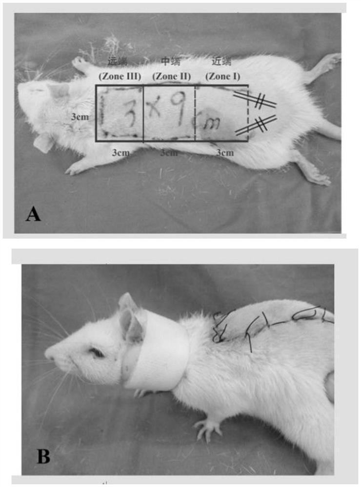 Effect of azadirachtin on preparation of medicament for promoting survival of ischemic ultralong random skin flap