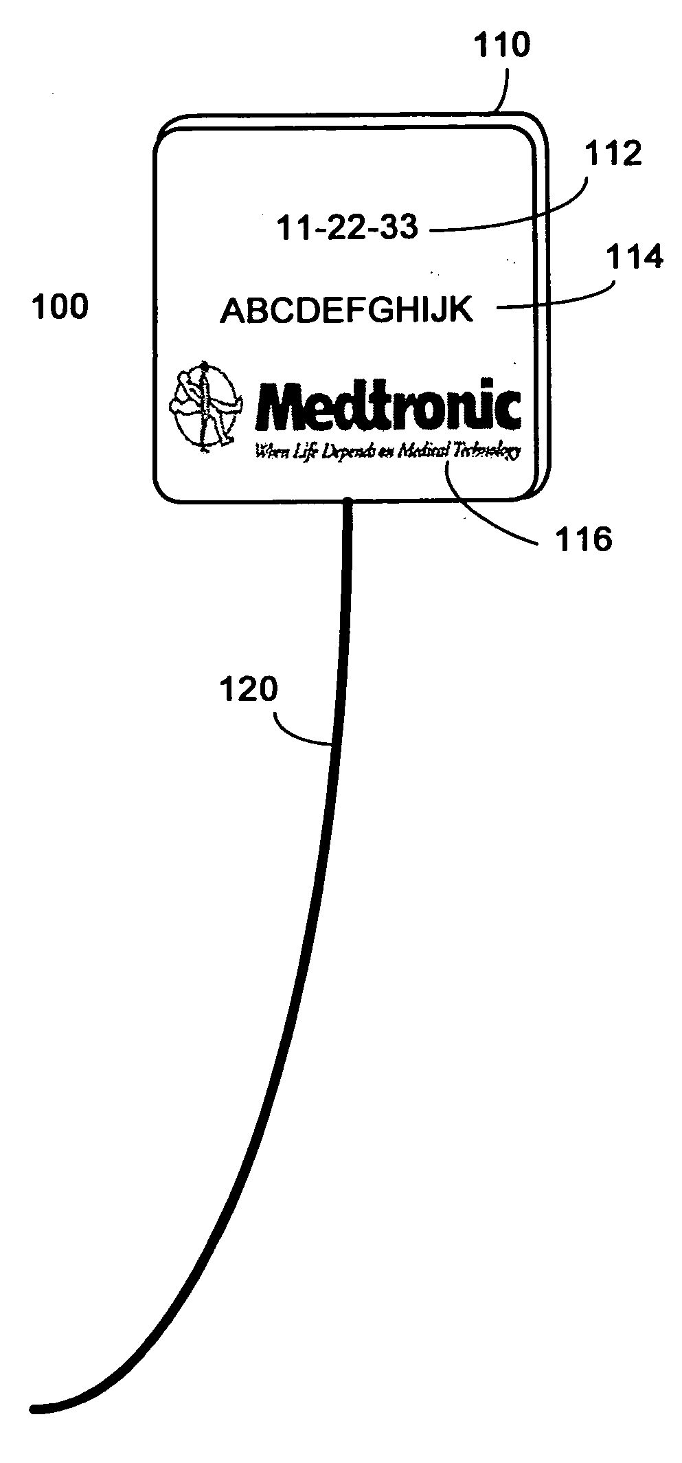 Twist-tie RFID tag