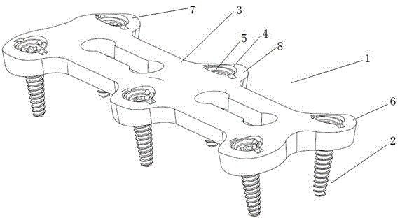 Spine fixing device