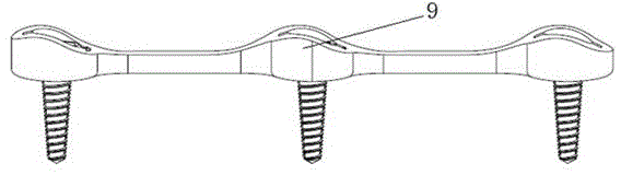 Spine fixing device