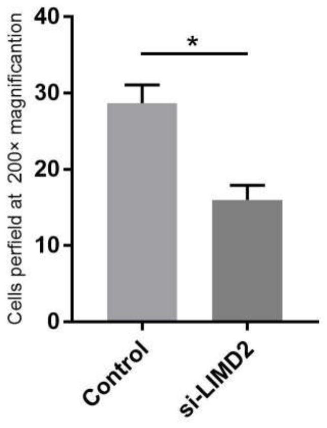 Application of siRNA sequence in preparation of medicine for treating ovarian cancer