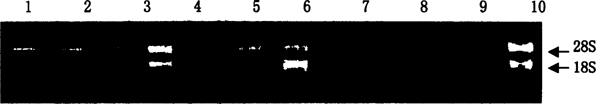 Method for extracting RNA from cotton tissue