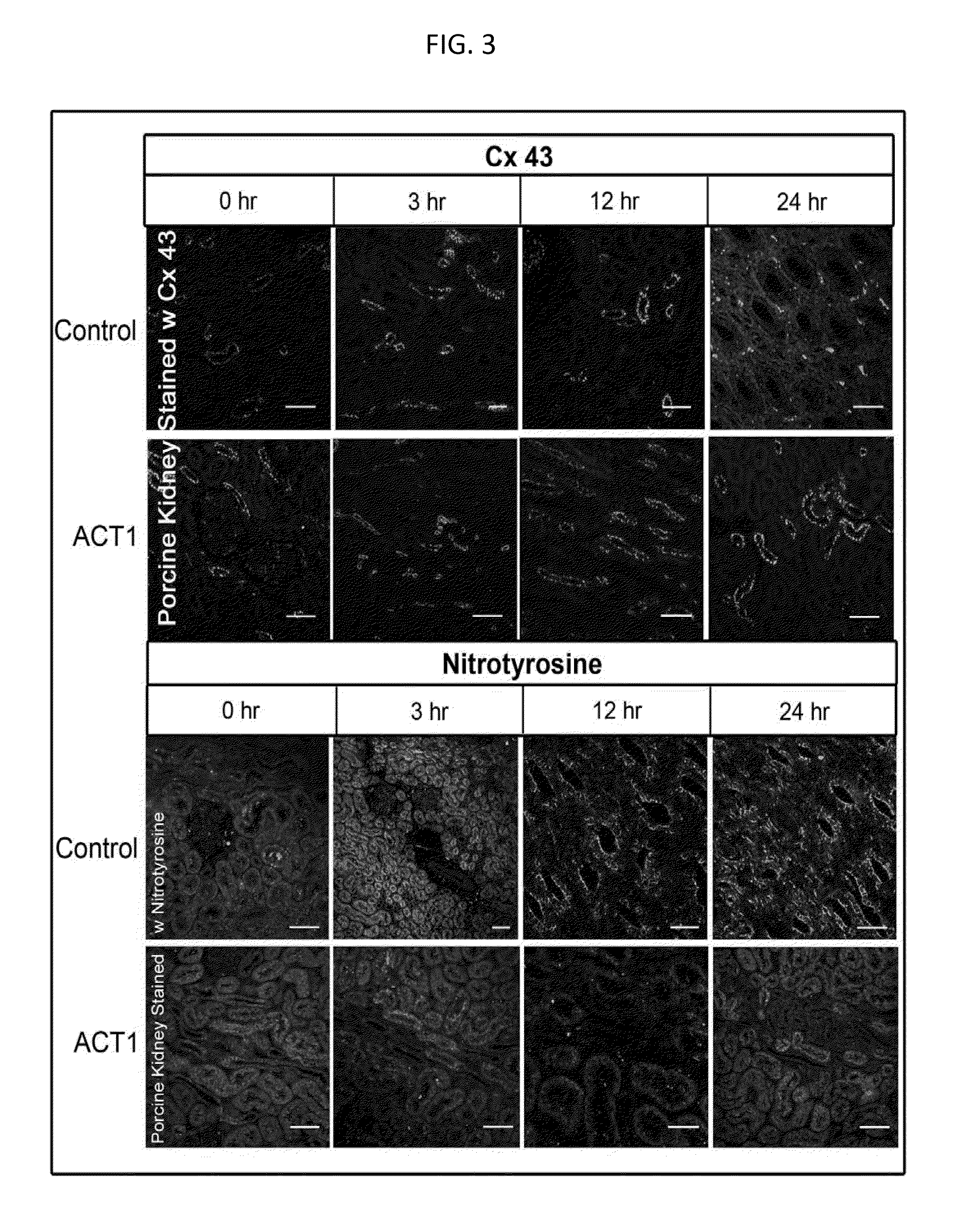 Alpha connexin c-terminal (ACT) peptides for use in transplant