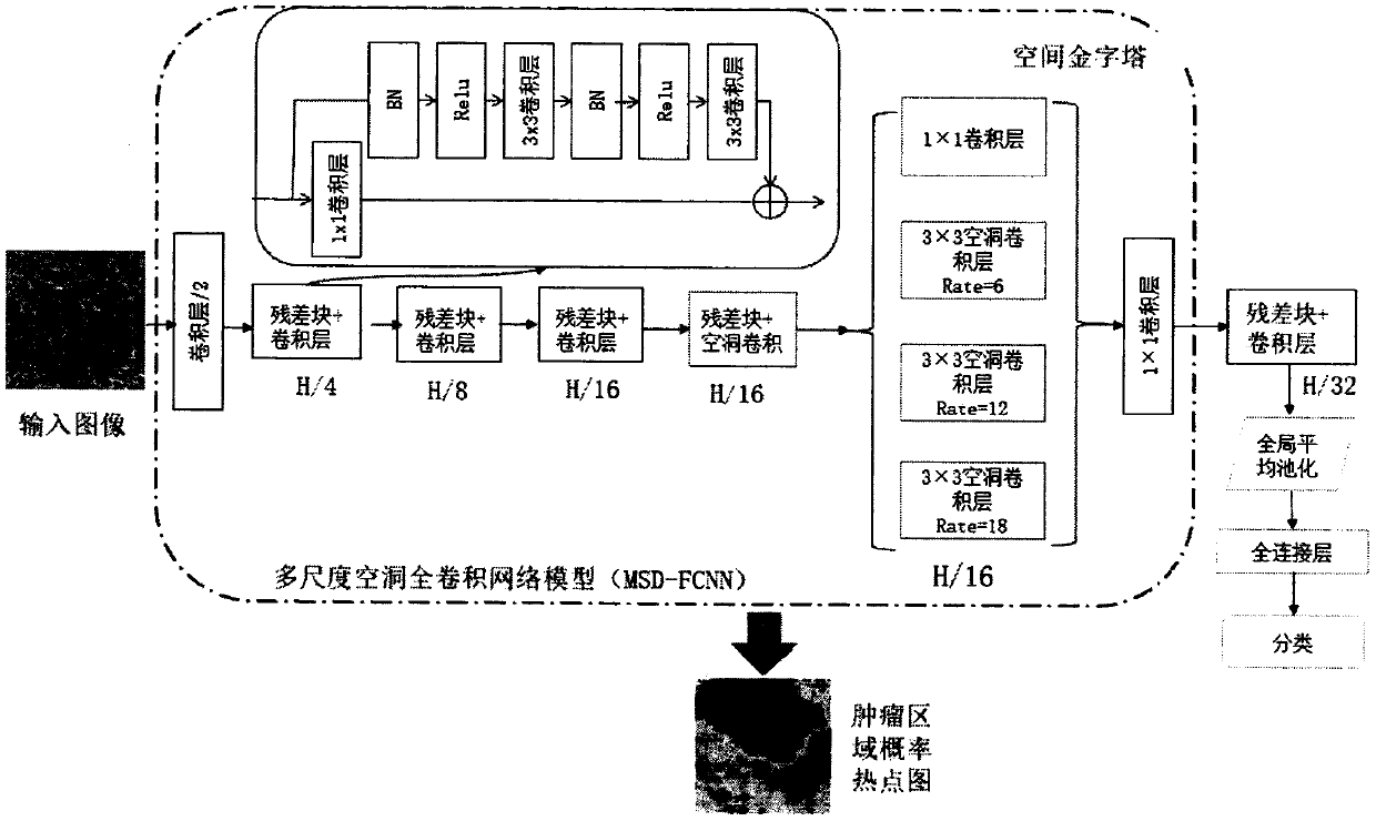 Ultrahigh-pixel tissue pathological image segmentation method