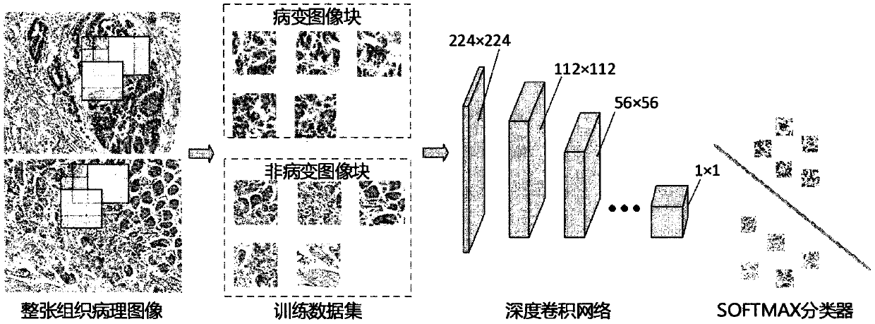 Ultrahigh-pixel tissue pathological image segmentation method