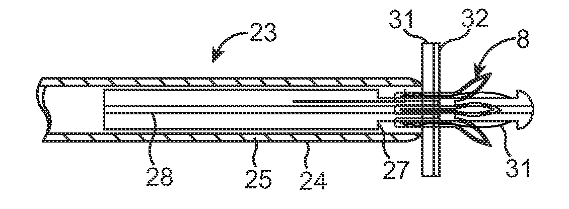 Device and method for establishing an artificial arterio-venous fistula