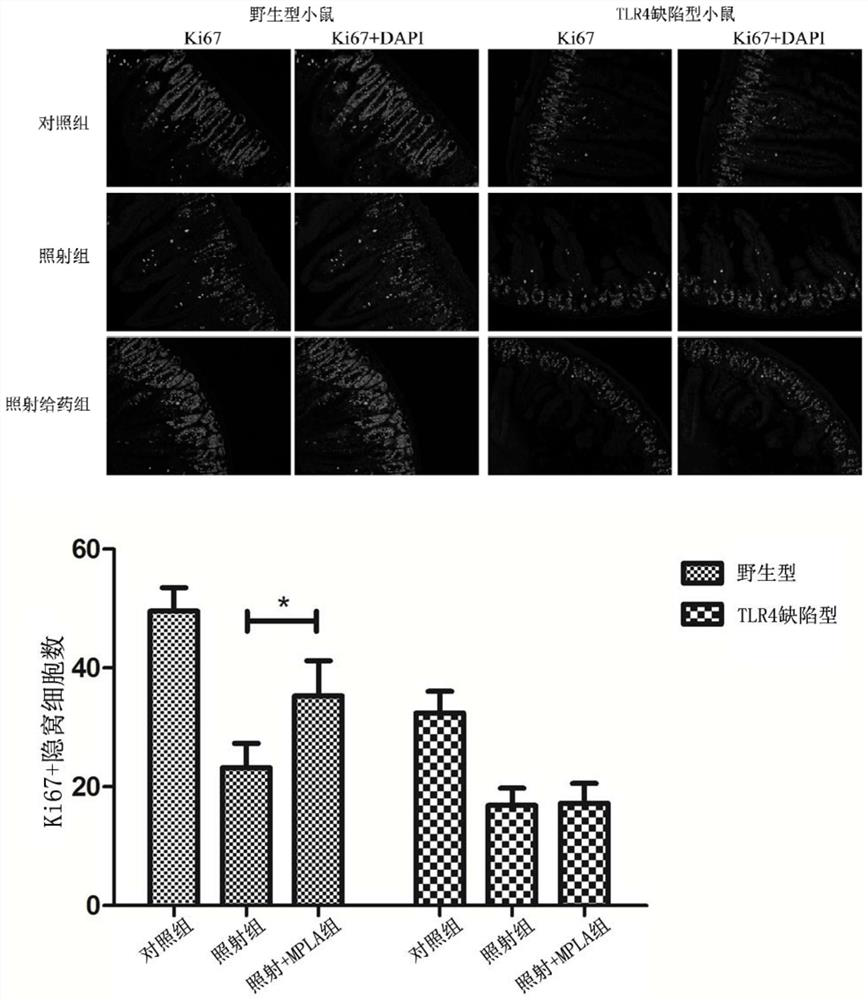 Application of mpla in the preparation of drugs for the prevention and treatment of intestinal damage caused by ionizing radiation