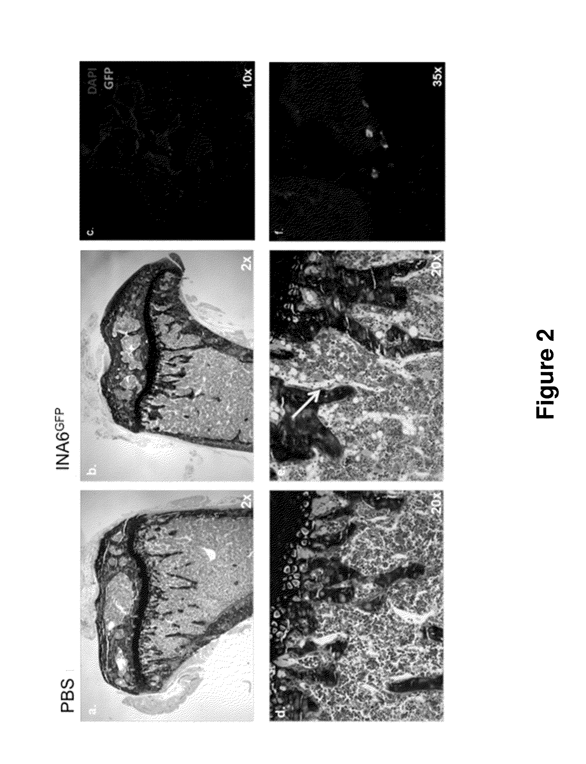 Genetically modified non-human animals and methods of use thereof