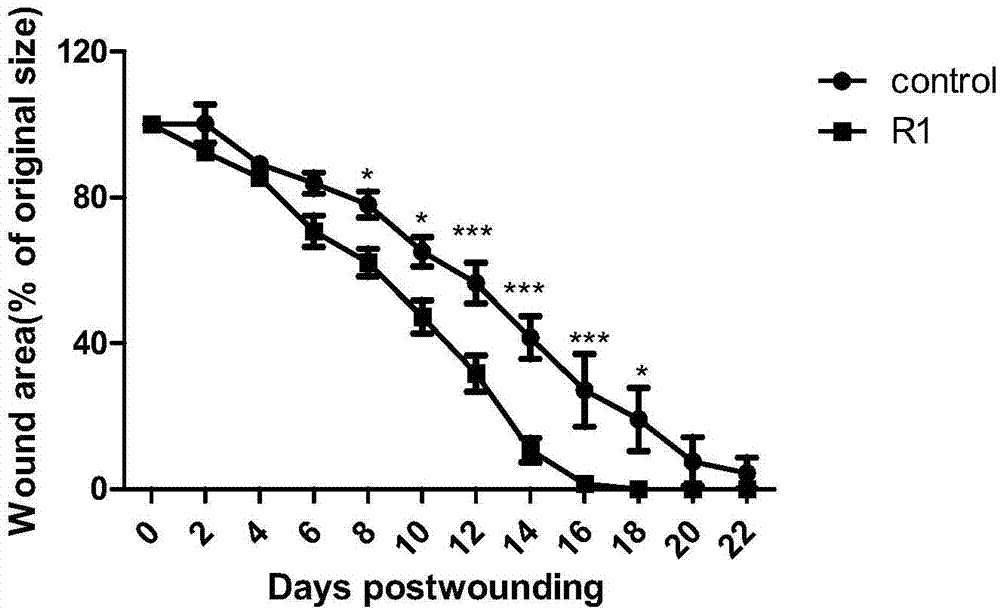 Medical application of notoginsenoside R1