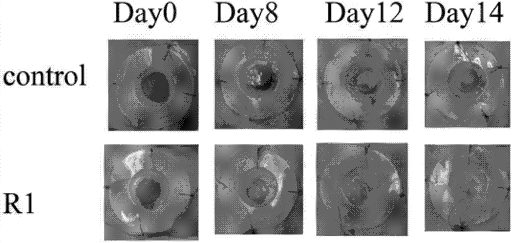 Medical application of notoginsenoside R1