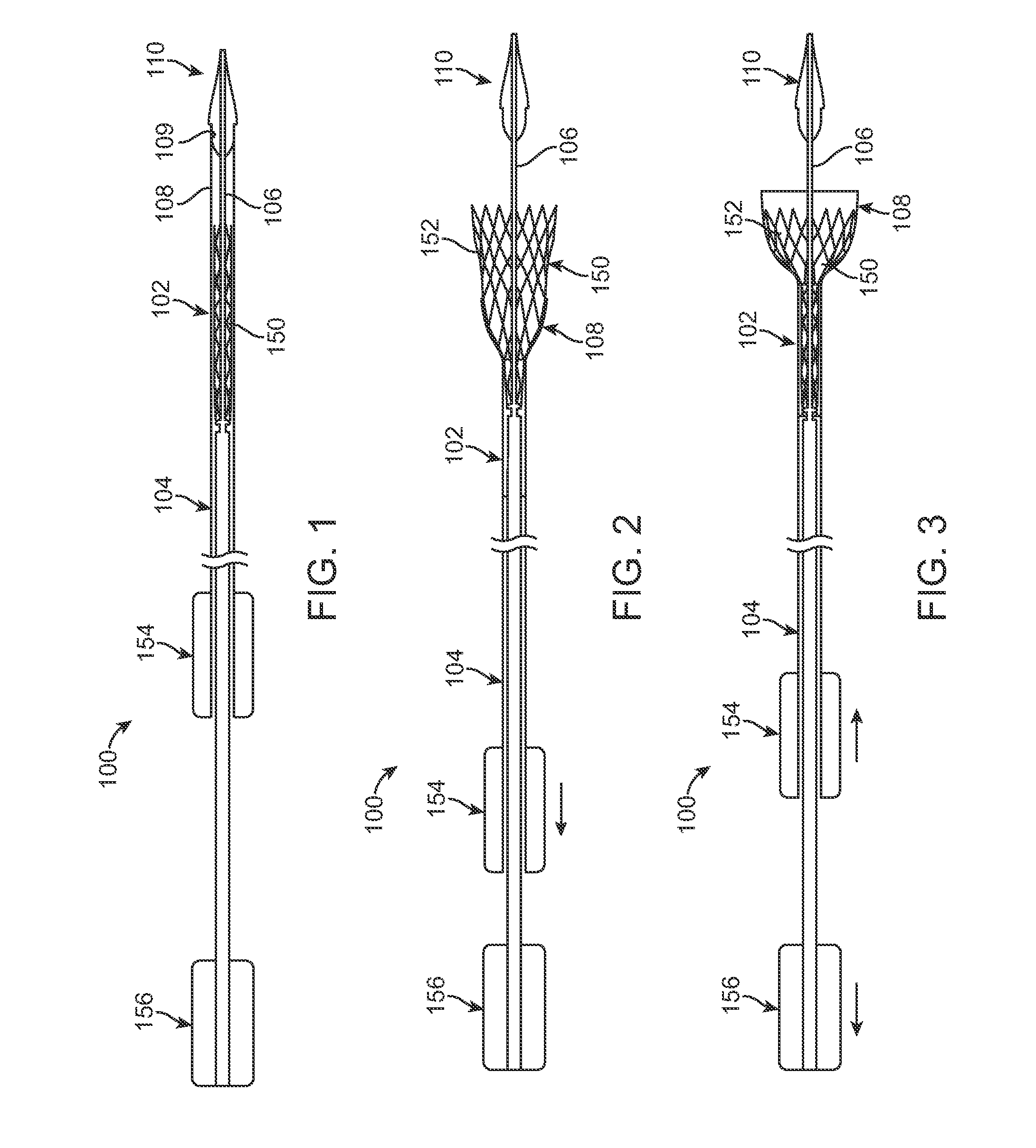 Distal tip for a delivery catheter