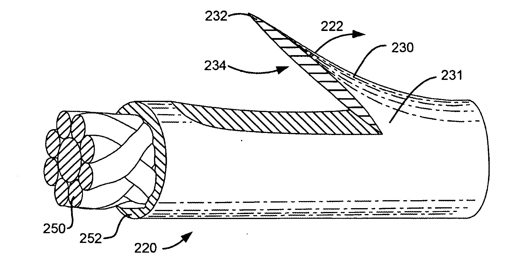 Braided self-retaining sutures and methods