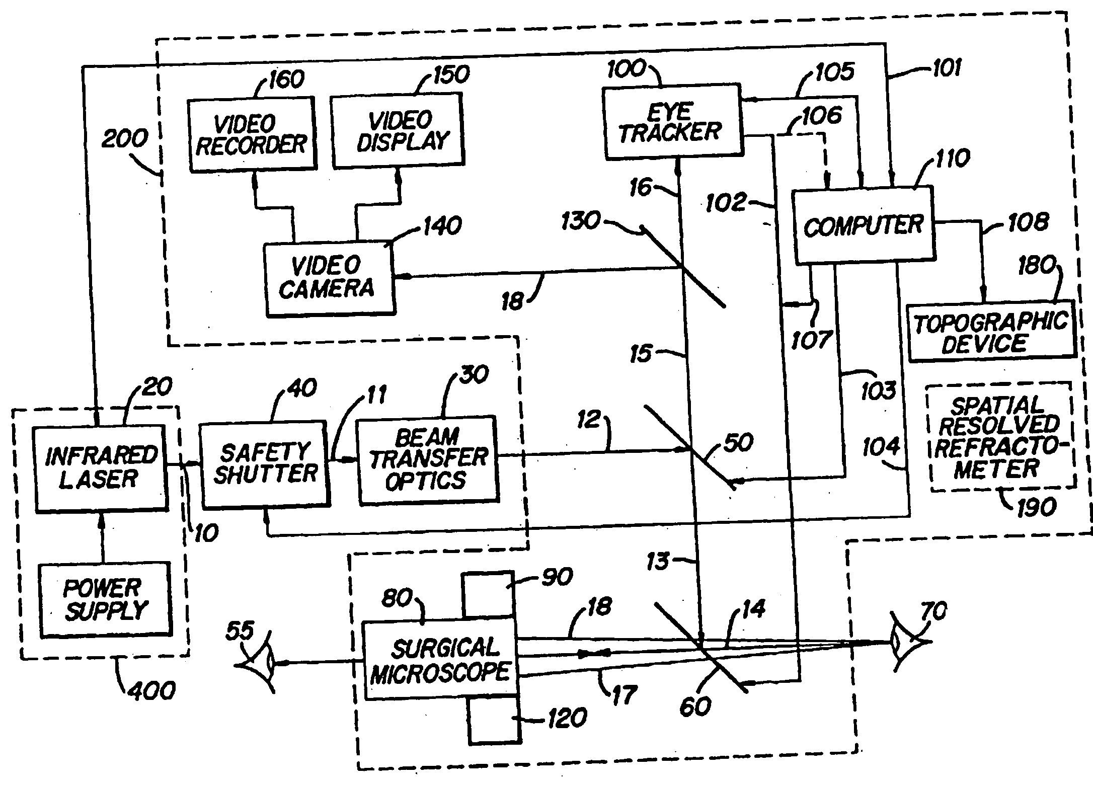 Method and apparatus for removing corneal tissue with infrared laser radiation and short pulse mid-infrared parametric generator for surgery