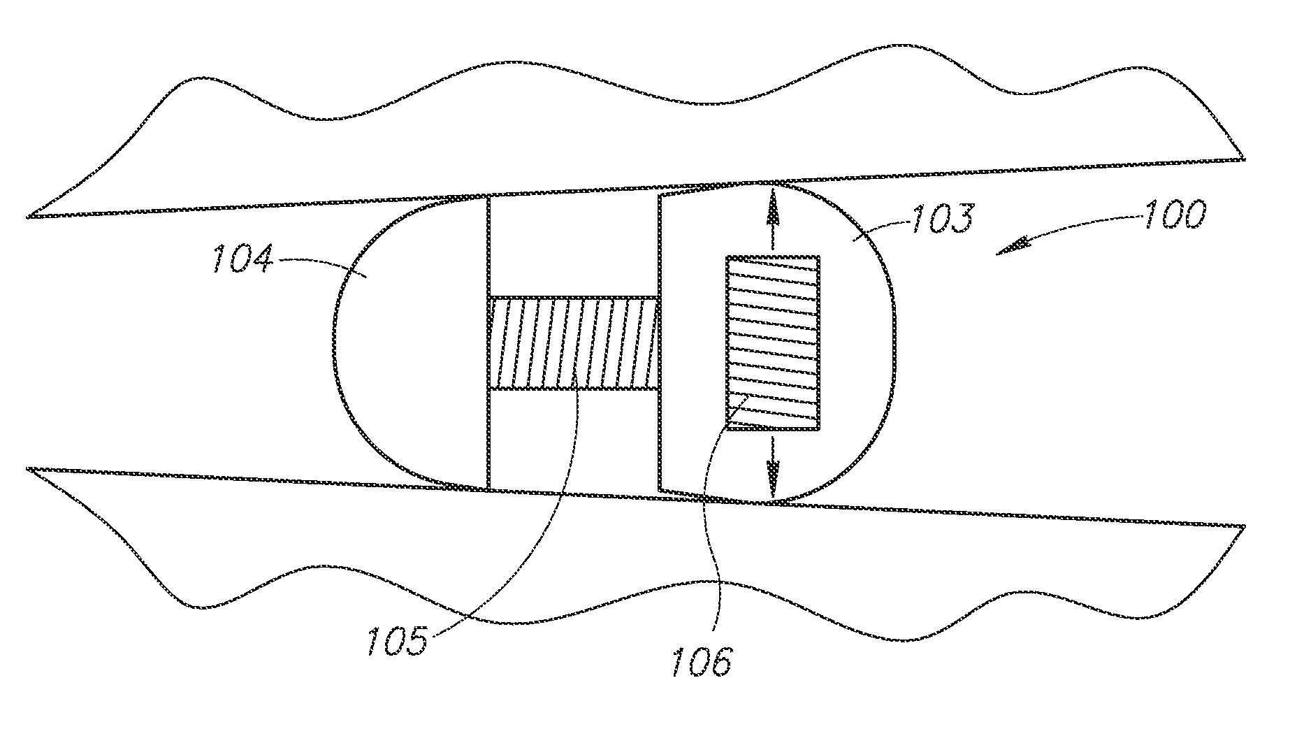 Spine surgery device