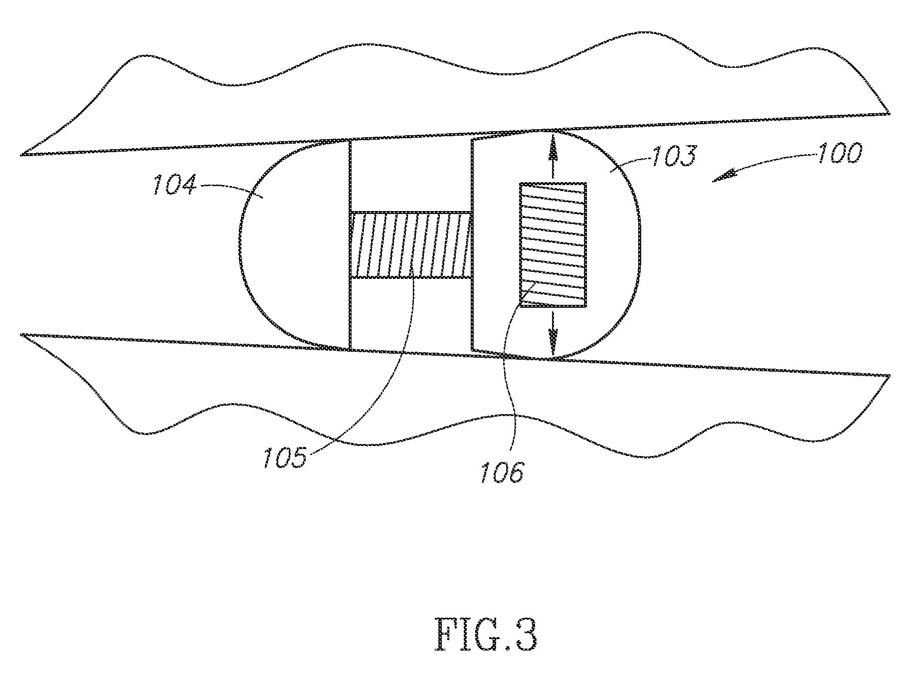 Spine surgery device