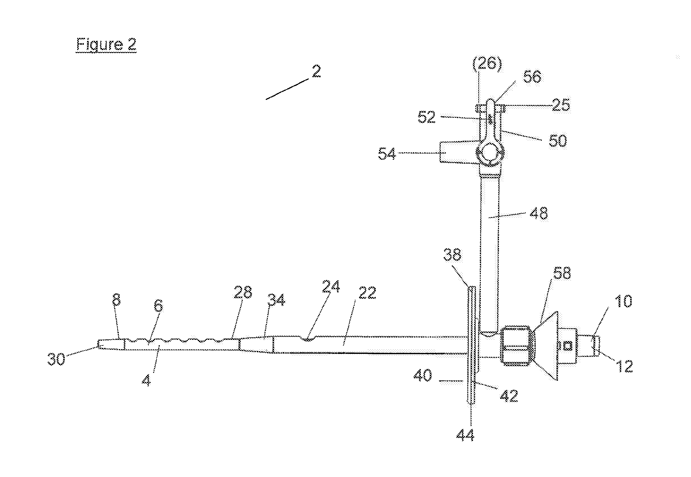 A pleural manometry catheter